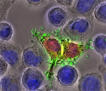 Listeria Update