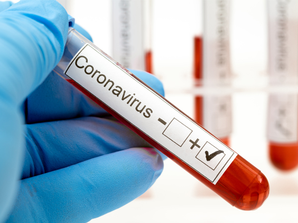 South Jersey Coronavirus (COVID-19) Developments (August 31)